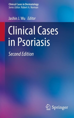 Clinical Cases in Psoriasis (2nd Edition)