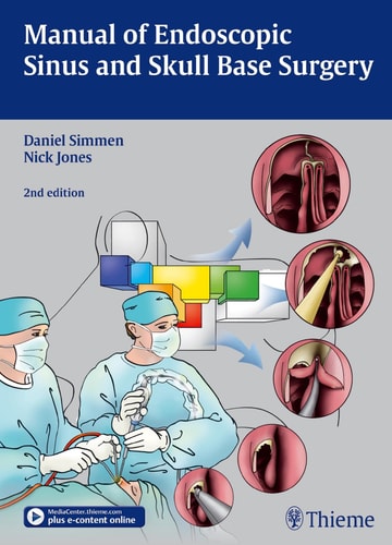 Manual of Endoscopic Sinus and Skull Base Surgery (2nd Edition)