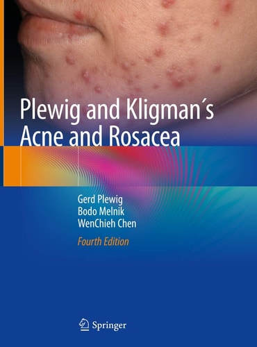 Plewig and Kligman´s Acne and Rosacea (4th Edition)