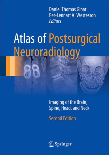 Atlas of Postsurgical Neuroradiology (Imaging of the Brain, Spine, Head, and Neck) (2nd Edition)