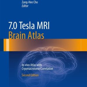 7.0 Tesla MRI Brain Atlas (In-vivo Atlas with Cryomacrotome Correlation) (2nd Edition)