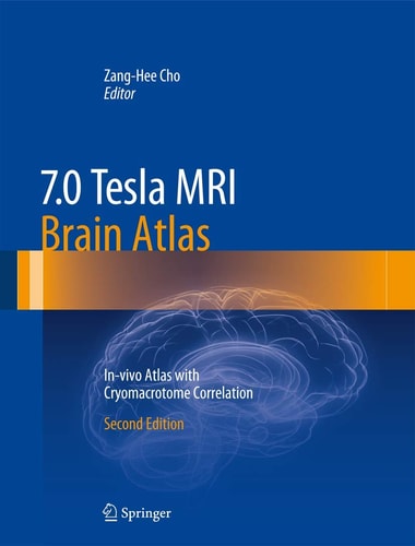 7.0 Tesla MRI Brain Atlas (In-vivo Atlas with Cryomacrotome Correlation) (2nd Edition)