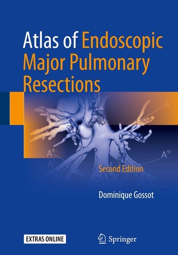 Atlas of Endoscopic Major Pulmonary Resections (2nd Edition)