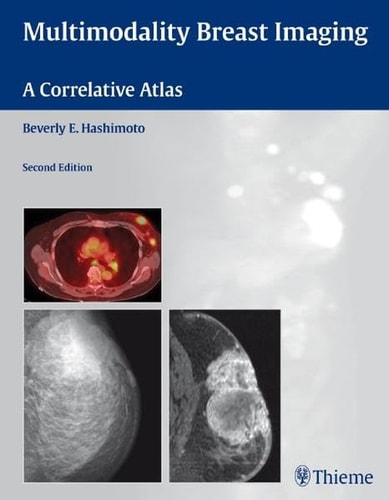 Multimodality Breast Imaging (A Correlative Atlas) (2nd Edition)