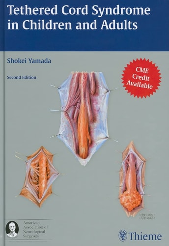 Tethered Cord Syndrome in Children and Adults (2nd Edition)