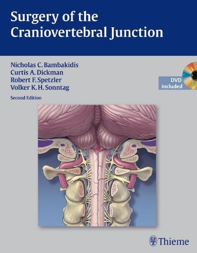 Surgery of the Craniovertebral Junction (2nd Edition)