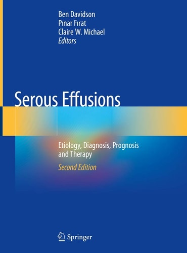 Serous Effusions (Etiology, Diagnosis, Prognosis and Therapy) (2nd Edition)