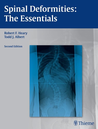 Spinal Deformities (The Essentials) (2nd Edition)