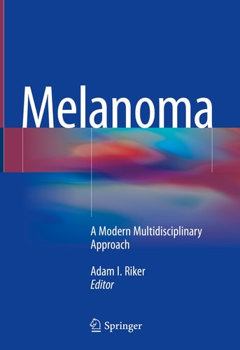 Melanoma A Modern Multidisciplinary Approach (1st Edition)