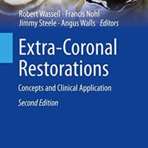 Extra-Coronal Restorations (Concepts and Clinical Application) (2nd Edition)