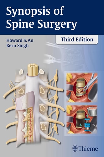 Synopsis of Spine Surgery (3rd Edition)