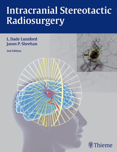 Intracranial Stereotactic Radiosurgery (2nd Edition)
