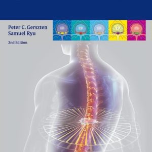 Spine Radiosurgery (2nd Edition)