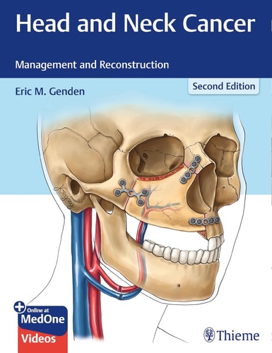 Head and Neck Cancer (Management and Reconstruction) (2nd Edition)
