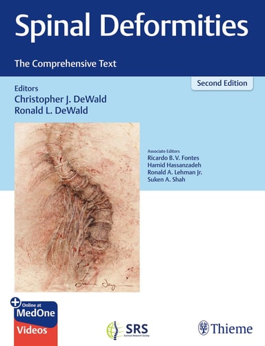 Spinal Deformities (The Comprehensive Text) (2nd Edition)