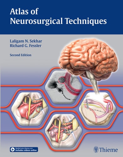 Atlas of Neurosurgical Techniques (Brain) (2nd Edition)
