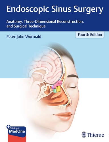 Endoscopic Sinus Surgery (Anatomy, Three-Dimensional Reconstruction, and Surgical Technique) (4th Edition)