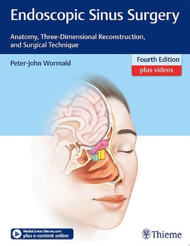 Endoscopic Sinus Surgery Anatomy, Three-Dimensional Reconstruction, and Surgical Technique (4th Edition)