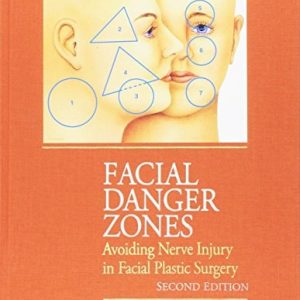 Facial Danger Zones (Avoiding Nerve Injury in Facial Plastic Surgery) (2nd Edition)