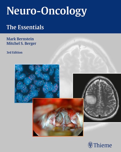 Neuro-Oncology: The Essentials (3rd Edition)
