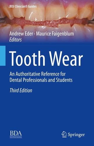Tooth Wear (An Authoritative Reference for Dental Professionals and Students) (3rd Edition)