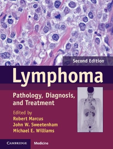 Lymphoma (Pathology, Diagnosis, and Treatment) (2nd Edition)