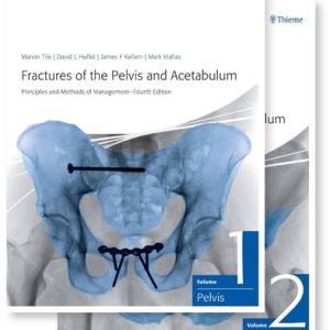 Fractures of the Pelvis and Acetabulum (Principles and Methods of Management) (4th Edition)