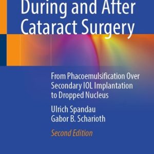 Complications During and After Cataract Surgery (From Phacoemulsification Over Secondary IOL Implantation to Dropped Nucleus) (2nd Edition)