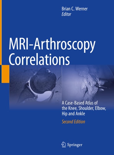 MRI-Arthroscopy Correlations (A Case-Based Atlas of the Knee, Shoulder, Elbow, Hip and Ankle) (2nd Edition)