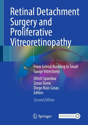 Retinal Detachment Surgery and Proliferative Vitreoretinopathy (From Scleral Buckling to Small Gauge Vitrectomy) (2nd Edition)