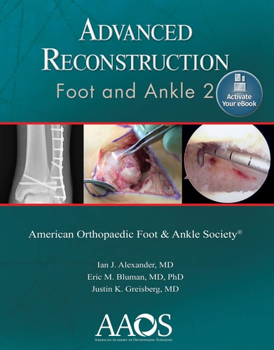 Advanced Reconstruction: Foot and Ankle 2 (2nd Edition)