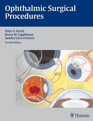 Ophthalmic Surgical Procedures (2nd Edition)