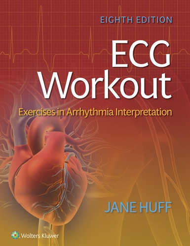 ECG Workout Exercises in Arrhythmia Interpretation (8th Edition)