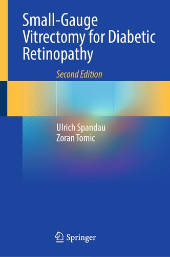 Small-Gauge Vitrectomy for Diabetic Retinopathy (2nd Edition)