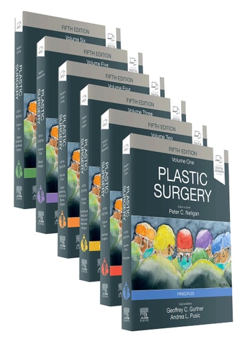 Plastic Surgery (5th Edition)