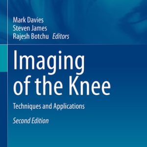 Imaging of the Knee (Techniques and Applications) (2nd Edition)