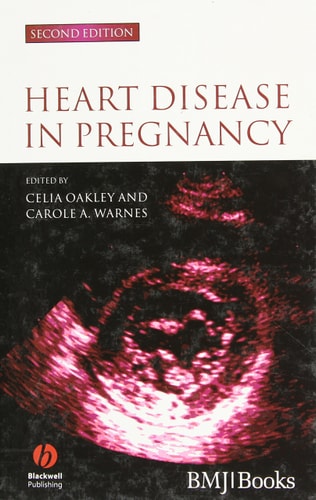 Heart Disease in Pregnancy (2nd Edition)