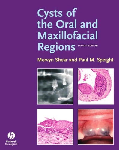 Cysts of the Oral and Maxillofacial Regions (4th Edition)