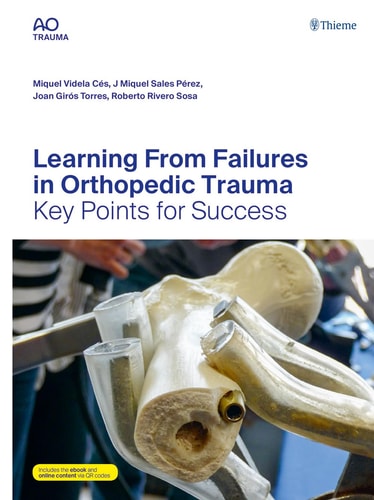 Learning from Failures in Orthopedic Trauma Key Points for Success (1st Edition)