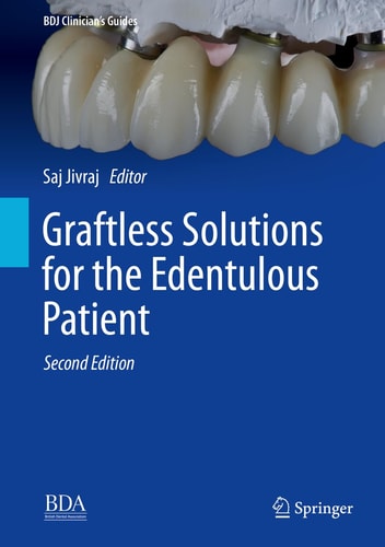Graftless Solutions for the Edentulous Patient (2nd Edition)