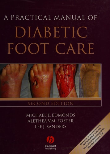 A Practical Manual of Diabetic Foot Care (2nd Edition)