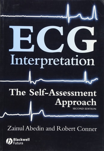 ECG Interpretation: The Self-Assessment Approach (The Self-Assessment Approach) (2nd Edition)
