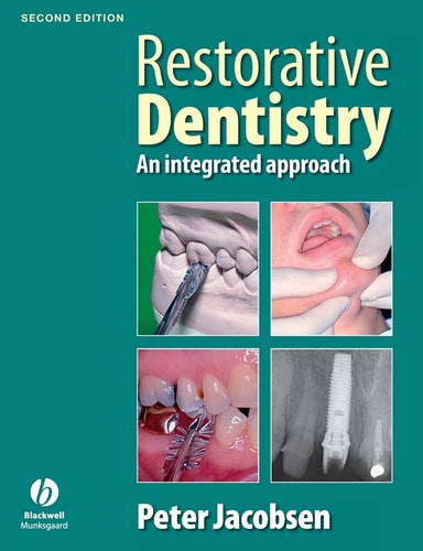 Restorative Dentistry (An Integrated Approach) (2nd Edition)