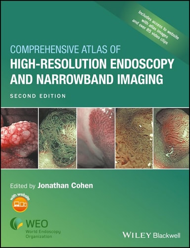 Comprehensive Atlas of High-Resolution Endoscopy and Narrowband Imaging (2nd Edition)