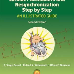 Cardiac Pacemakers and Resynchronization Step by Step: An Illustrated Guide (An Illustrated Guide) (2nd Edition)