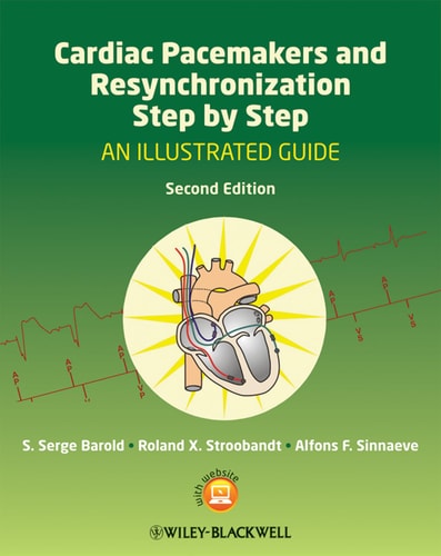 Cardiac Pacemakers and Resynchronization Step by Step: An Illustrated Guide (An Illustrated Guide) (2nd Edition)