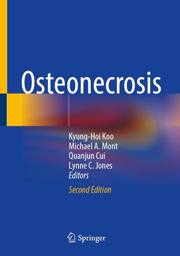 Osteonecrosis (2nd Edition)