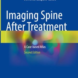 Imaging Spine After Treatment (A Case-based Atlas) (2nd Edition)