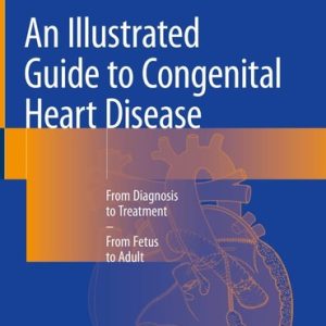An Illustrated Guide to Congenital Heart Disease From Diagnosis to Treatment – From Fetus to Adult (1st Edition)