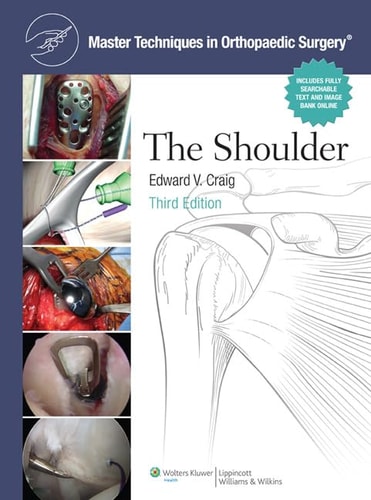 The Master Techniques in Orthopaedic Surgery: Shoulder (3rd Edition)